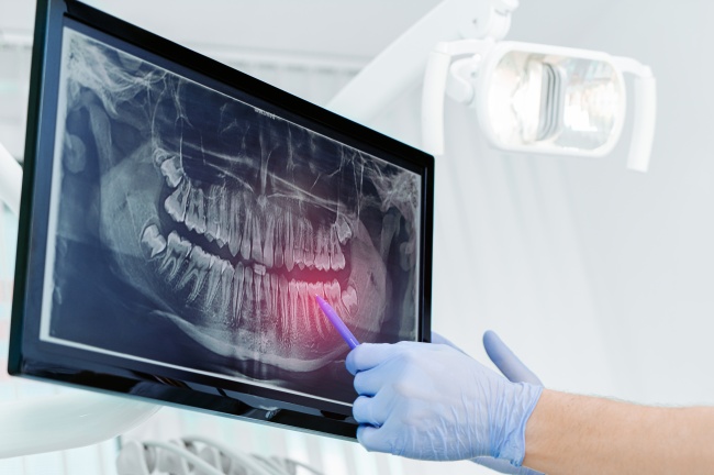 dental xrays