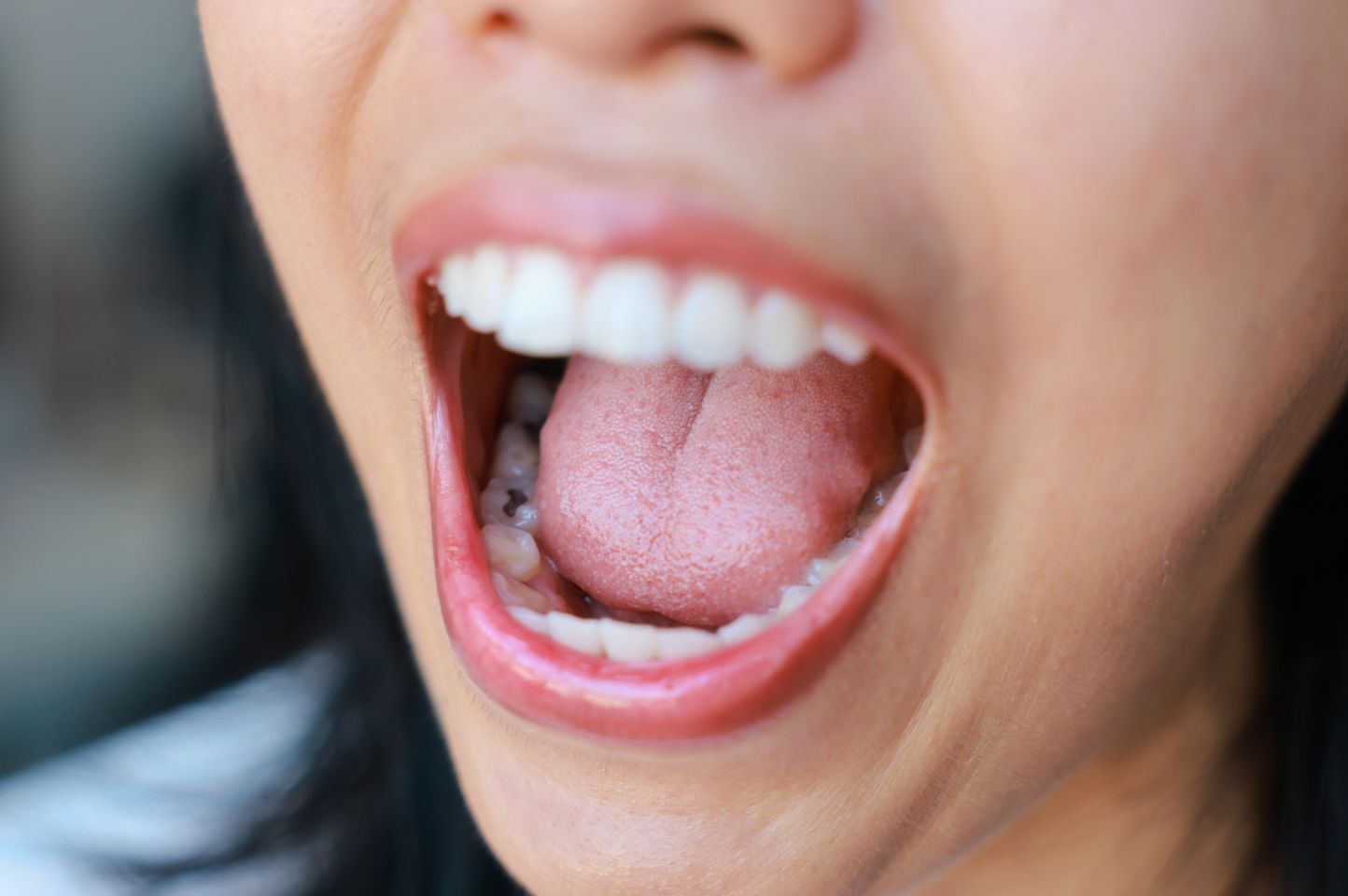 Blog Inner - Moltons Dental
