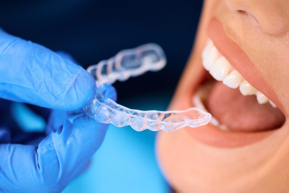 moltonsdental-offer-image