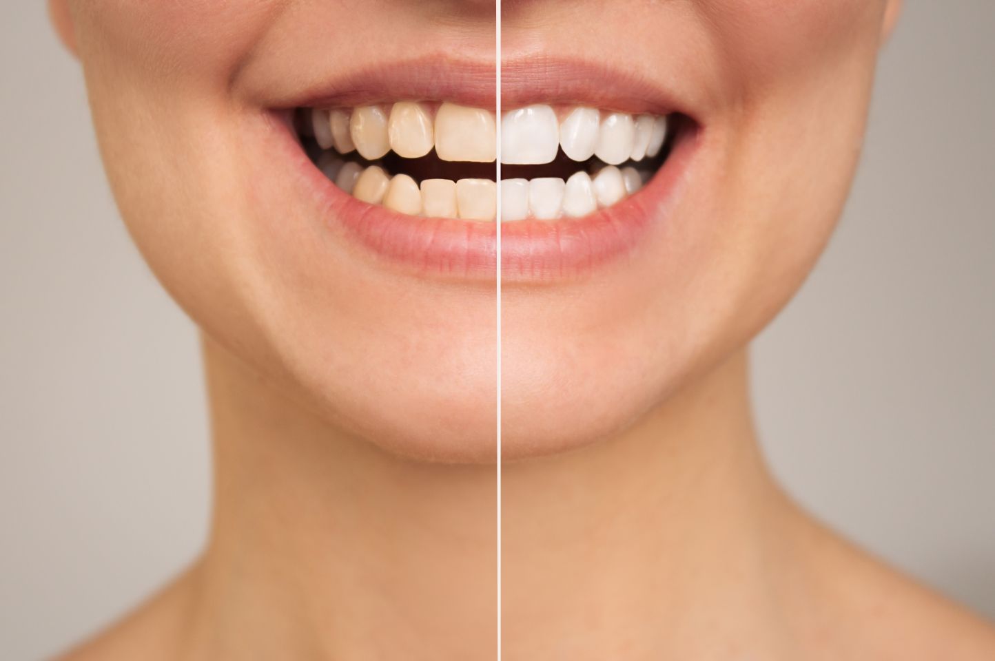 Blog Inner - Moltons Dental
